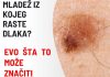 IMATE LI MLADEŽ IZ KOJEG RASTE DLAKA? Evo šta to može značiti
