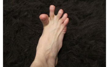 DA LI VAM SE GRČE PRSTI NA STOPALIMA? Evo na šta vas to upozorava, može biti znak većih problema
