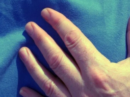 Kardiolozi upozoravaju na 2 rana simptoma srčanog udara koja se često ignoriraju