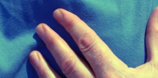 Kardiolozi upozoravaju na 2 rana simptoma srčanog udara koja se često ignoriraju