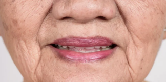 Znak DEMENCIJE koji se javlja u ustima: Ako ovo osjećate, javite se LJEKARU!