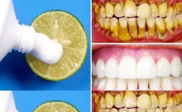 Za samo dva minuta – Prirodno izbjelite zube ovom metodom