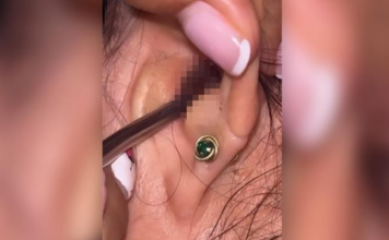 SVRBELO JE UVO DO BESVESTI, OTIŠLA U BOLNICU, A TAMO ŠOK: Kada su videli šta je unutra nisu mogli da veruju svojim očima! (FOTO)