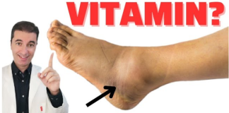 Ključni VITAMIN za uklanjanje OTEKLINA NOGU, NOŽNIH ZGLOBOVA I STOPALA!