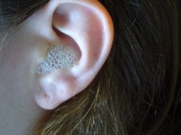 AKO VAS MUČI ZAČEPLJENO UHO, evo kako ga odčepiti prirodnim putem i bez puno boli GENIJALAN SAVJET