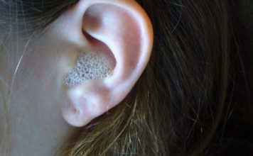 AKO VAS MUČI ZAČEPLJENO UHO, evo kako ga odčepiti prirodnim putem i bez puno boli GENIJALAN SAVJET