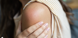 BOL U RAMENU MOŽE DA BUDE SIMPTOM OZBILJNE BOLESTI: Ako imate iove tegobe, obavezno kod ljekara