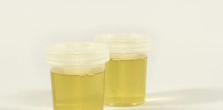 Vidite li mjehuriće u urinu? To može ukazivati na ozbiljnije zdravstveno stanje!