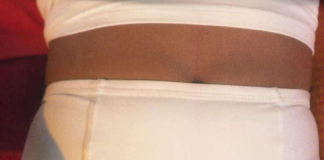 10 SIMPTOMA KOJE SVAKA ŽENA MORA ZNATI: Upozoravaju na mogući RAK JAJNIKA