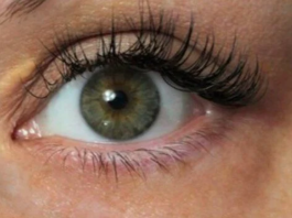 Dvije promjene na licu mogu ukazivati na povišen holesterol!