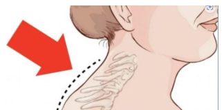 Kiropraktičar je pokazao 3 jednostavne vježbe koje će vam pomoći da uklonite “Grbu” u vratu: 0vo mi je najviše pomoglo! VIDEO