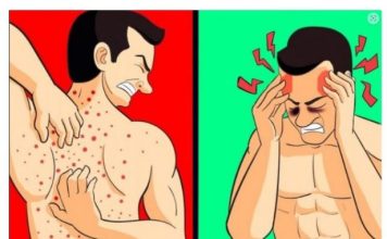 VAŠE TIJELO VAM ŠALJE UPOZORENJE: 12 znakova da jedete previše šećera SHVATITE OZBILJNO! Broj 5 nikako ne zanemarujte!