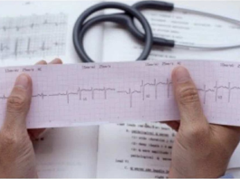 KOJA RUKA BOLI PRED INFARKT: Srčani udar najavljuje ovaj rani simptom, spriječite to