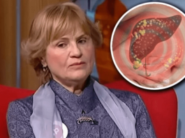 DOKTORKA RADMILA 0TKILA KOJE SU NAJBOLJE NAMIRNICE ZA MASNU JETRU: Ono što je rekla o SURUTKI, mnoge će ŠOKIRATI
