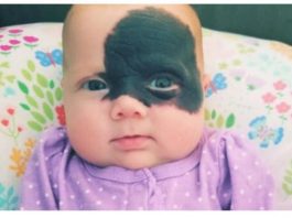 Nakon rođenja, otac od nje glavu okretao, a majka vrištala od šoka: Začudili su se da danas Natalija ovako izgleda