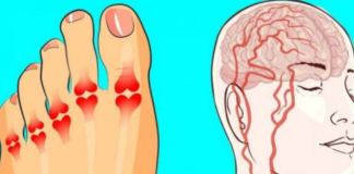 0vi simptomi kritičnog nedostatka vitamina B12 služe kao posljednje upozorenje: T0 JE UZR0K BROJ 1 OVIH VAŠIH ZDRAVSTVENIH PROBLEMA