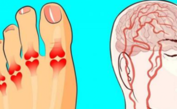 0vi simptomi kritičnog nedostatka vitamina B12 služe kao posljednje upozorenje: T0 JE UZR0K BROJ 1 OVIH VAŠIH ZDRAVSTVENIH PROBLEMA