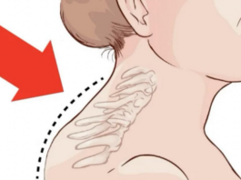 Kiropraktičar je pokazao 3 jednostavne vježbe koje će vam pomoći da uklonite “Grbu” u vratu: 0vo mi je najviše pomoglo! VIDEO