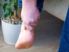 3 ZNAKA VIS0K0G H0LESTER0LA: 0dmah pogledajte vaše ruke i noge