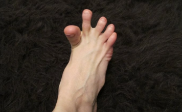 DA LI VAM SE GRČE PRSTI NA STOPALIMA? Evo na šta vas to upozorava, može biti znak većih problema