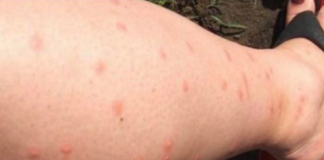 KOMARCI VAM PRAVE PAKAO OD ŽIVOTA? Samo isijecite OVO VOĆE na pola i ostavite u sobi, VIŠE IH NIKADA NEĆETE VIDJETI BLIZU!