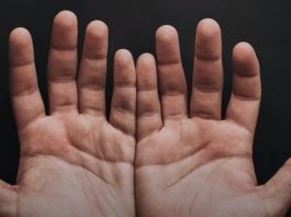 Ove linije na dlanu imaju samo posebni ljudi, nema ih mnogo, iznenadićete se kada čujete šta znače