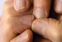 MUČE VAS UMOR, TANKA KOSA I LOMLJIVI NOKTI, EVO ŠTAVAM NEDOSTAJE U ISHRANI