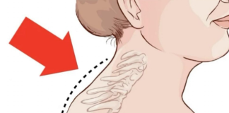 Kiropraktičar je pokazao 3 jednostavne vježbe koje će vam pomoći da ukl0nite “Grbu” u vratu: 0vo mi je najviše pomoglo! VIDEO