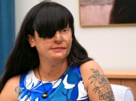 “Nakon raskida polio je kiselinom,oslijepio je i unakazio – Ona nakon 2 godine donijela sok odluku” Borio se za nju 2 godine…”