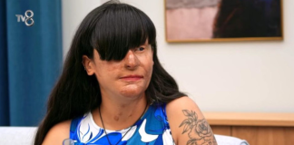 “Nakon raskida polio je kiselinom,oslijepio je i unakazio – Ona nakon 2 godine donijela sok odluku” Borio se za nju 2 godine…”