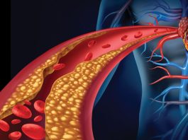 Zujanje u ušima? Uklonite ga u samo pet sekundi kroz jednu vježbu!