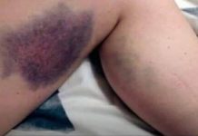 Vitamini koje je zabranjeno uzimati zajedno, ALI NIKO NE ZNA, MOGU BITI OPASNI