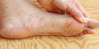 7 znakova da se tijelo već duže vrijeme bori s VISOKIM ŠEĆEROM U KRVI: Prvo ćete to primijetiti na očima i nogama!