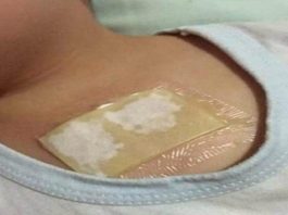 Ovaj kućni lijek rastvara sluz u plućima i oslobađa kašlja. Preko noći uklanja i najteži kašalj, te čisti pluća od nakupljene sluzi! Ovaj kućni lijek rastvara sluz u plućima i oslobađa kašlja. Preko noći uklanja i najteži kašalj, te čisti pluća od nakupljene sluzi! - featured image