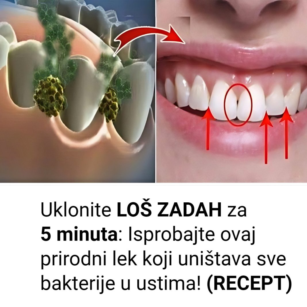 Isprobajte prirodni lek koji uništava bakterije u ustima i neprijatan zadah - featured image