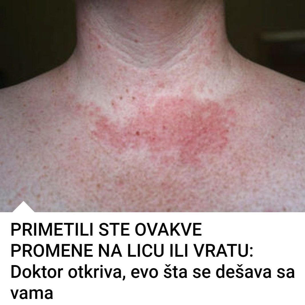 Promene na koži: Doktor otkriva šta se dešava sa vama - featured image