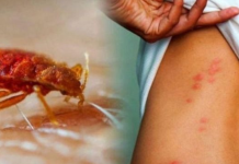 STJENICE U DOMU: PREPOZNAJTE IH NA VRIJEME I RIJEŠITE SE NAJBRŽE MOGUĆE