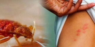 STJENICE U DOMU: PREPOZNAJTE IH NA VRIJEME I RIJEŠITE SE NAJBRŽE MOGUĆE