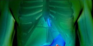 6 NAJRANIJIH SIMPTOMA RAKA ŽELUCA: Ovako tijelo šalje znak da se u organizmu razvija opaki tumor! 6 NAJRANIJIH SIMPTOMA RAKA ŽELUCA: Ovako tijelo šalje znak da se u organizmu razvija opaki tumor! - featured image