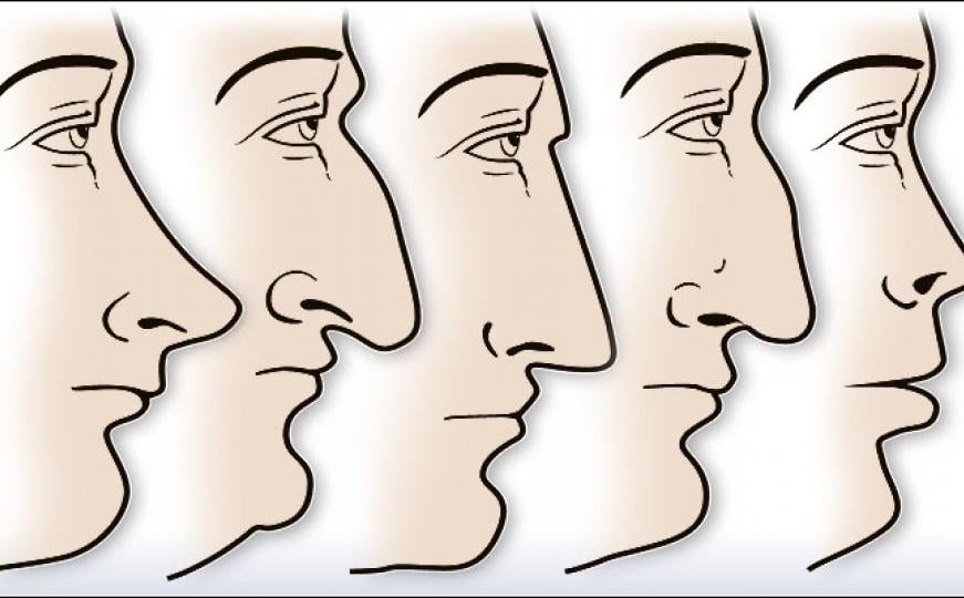 ZVUČI ČUDNO, ALI JE ISTINITO: Evo šta OBLIK NOSA govori O VAMA! Svima je pogodilo - featured image ZVUČI ČUDNO, ALI JE ISTINITO: Evo šta OBLIK NOSA govori O VAMA! Svima je pogodilo - featured image