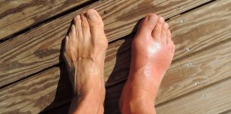 7 namirnica koje potiho stvaraju mokraćnu kiselinu i uništavaju vaše zglobove 7 namirnica koje potiho stvaraju mokraćnu kiselinu i uništavaju vaše zglobove - featured image