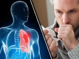 Nikad više nećete dobiti bronhitis i kašalj: Prirodni lek za decu i odrasle Nikad više nećete dobiti bronhitis i kašalj: Prirodni lek za decu i odrasle - featured image