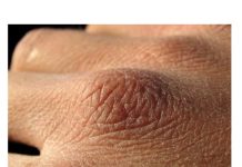 Puca vam koža, opada kosa ili imate grčeve? Tijelo vam govori da vam nedostaju ovi vitamini Puca vam koža, opada kosa ili imate grčeve? Tijelo vam govori da vam nedostaju ovi vitamini - featured image