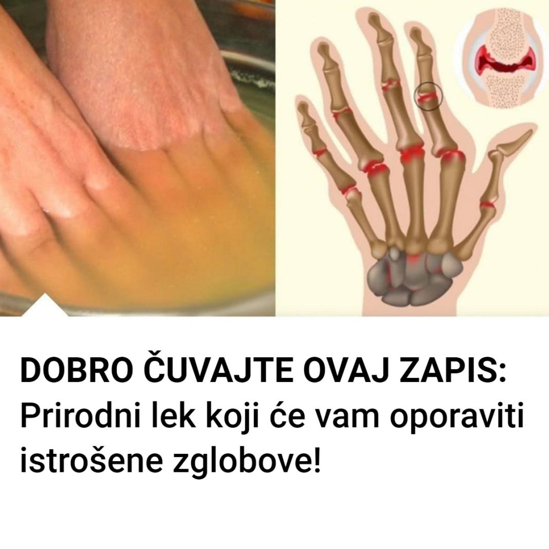 Bolovi u zglobovima ruku i nogu simptomi i lečenje - featured image Bolovi u zglobovima ruku i nogu simptomi i lečenje - featured image