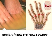 Bolovi u zglobovima ruku i nogu simptomi i lečenje Bolovi u zglobovima ruku i nogu simptomi i lečenje - featured image