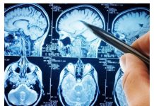 POVRĆE JE TOLIKO ZDRAVO DA O NJEMU PIŠE NJUJORK TAJMS: Amerikanci daju po 30 dolara za jedan list, a ono raste kod nas POVRĆE JE TOLIKO ZDRAVO DA O NJEMU PIŠE NJUJORK TAJMS: Amerikanci daju po 30 dolara za jedan list, a ono raste kod nas - featured image