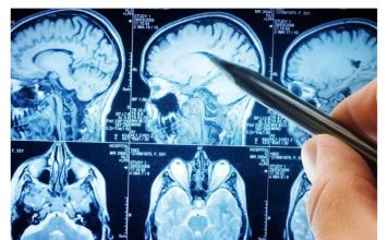 POVRĆE JE TOLIKO ZDRAVO DA O NJEMU PIŠE NJUJORK TAJMS: Amerikanci daju po 30 dolara za jedan list, a ono raste kod nas POVRĆE JE TOLIKO ZDRAVO DA O NJEMU PIŠE NJUJORK TAJMS: Amerikanci daju po 30 dolara za jedan list, a ono raste kod nas - featured image