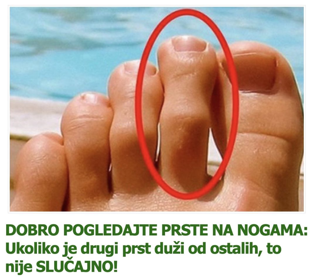 DOBRO POGLEDAJTE PRSTE NA NOGAMA: Ukoliko je drugi prst duži od ostalih, to nije SLUČAJNO! - featured image DOBRO POGLEDAJTE PRSTE NA NOGAMA: Ukoliko je drugi prst duži od ostalih, to nije SLUČAJNO! - featured image
