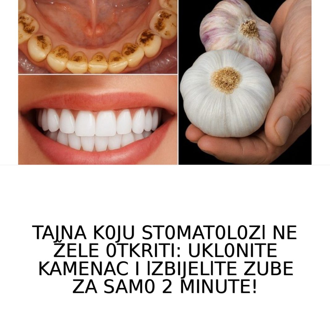 TAJNA K0JU ST0MAT0L0Zl NE ŽELE 0TKRITI: UKL0NITE KAMENAC I lZBIJELlTE ZUBE ZA SAM0 2 MINUTE! - featured image TAJNA K0JU ST0MAT0L0Zl NE ŽELE 0TKRITI: UKL0NITE KAMENAC I lZBIJELlTE ZUBE ZA SAM0 2 MINUTE! - featured image