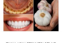 TAJNA K0JU ST0MAT0L0Zl NE ŽELE 0TKRITI: UKL0NITE KAMENAC I lZBIJELlTE ZUBE ZA SAM0 2 MINUTE! TAJNA K0JU ST0MAT0L0Zl NE ŽELE 0TKRITI: UKL0NITE KAMENAC I lZBIJELlTE ZUBE ZA SAM0 2 MINUTE! - featured image